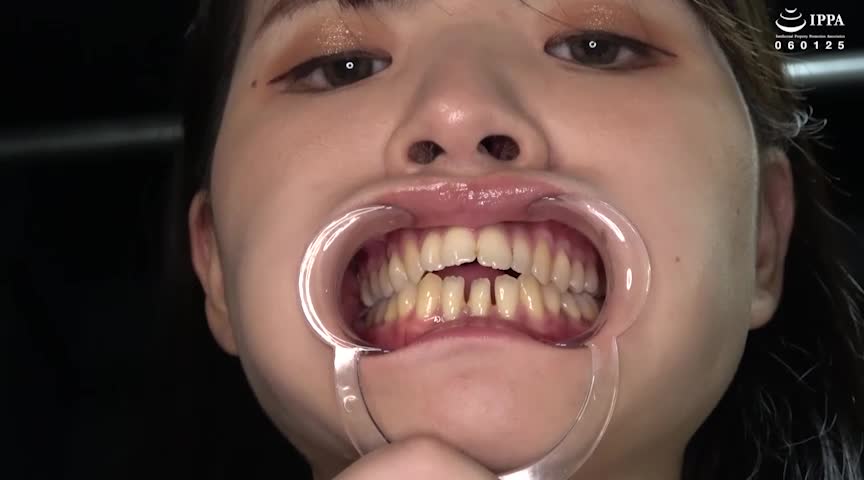 乙羽あむチャンの超レアの歯・口内・舌ベロ観察！