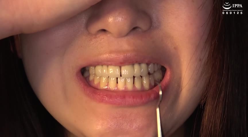 口内・歯・歯抜け・のどちんこ観察プレイ！素人美女ナナ
