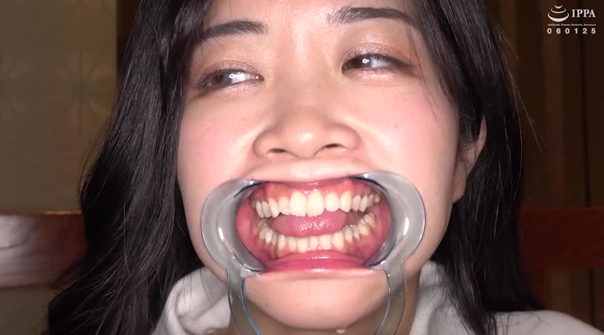 初めての口内・のどちんこ観察！ことね（5）