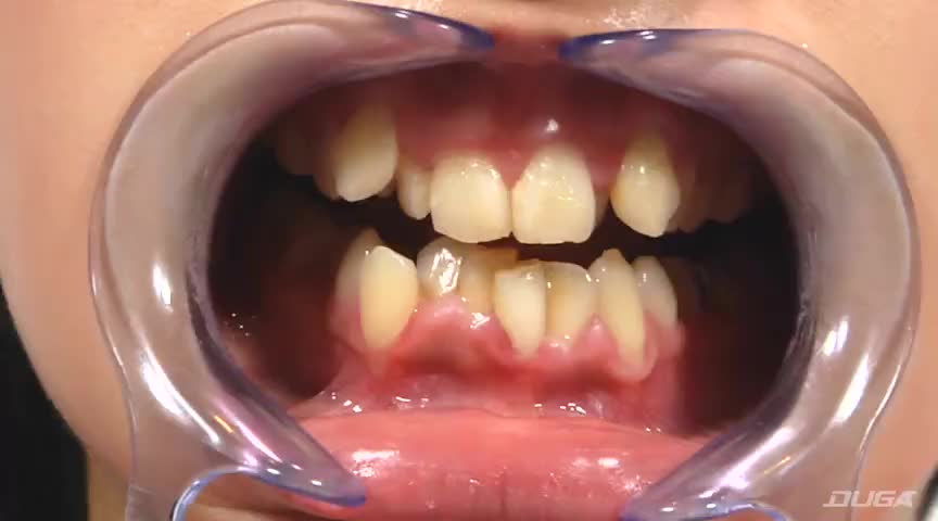 歯13