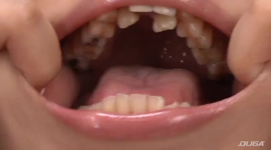 歯17
