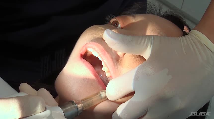 歯フェチ！本物の歯治療映像【抜歯】 ミランダ