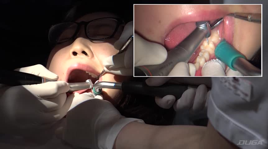 歯フェチ！本物歯科治療映像 約10年ぶりの治療に麻酔無しで挑むが…安田ななは