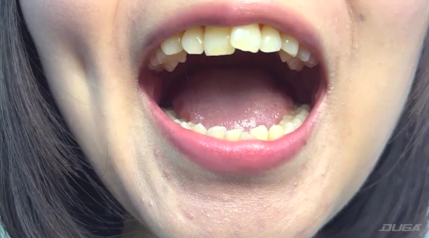 街角で声をかけて口内観察させてもらう テレビ局AD みゆりちゃん